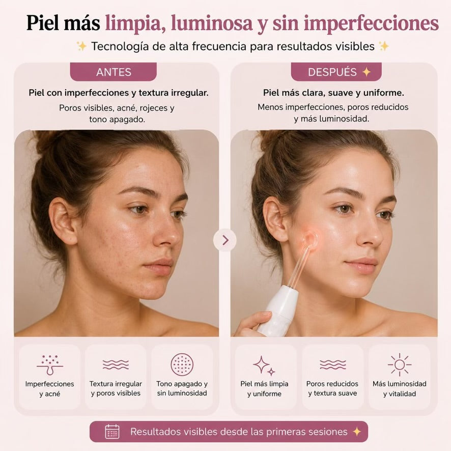 Alta Frecuencia Facial Profesional