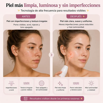 Alta Frecuencia Facial Profesional